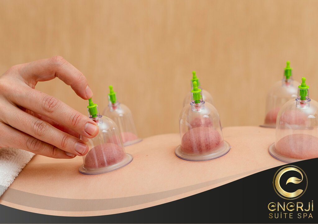 Çorlu Cupping Masaj